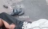 一哥们儿遭遇车祸，命根子被扯掉了1V
