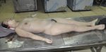 车祸遭受颅脑损伤的丰满女人尸检 高清17P